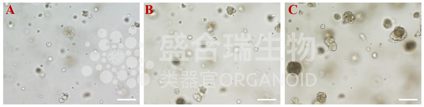 乳腺癌类器官复苏培养过程图