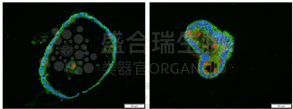 人结肠类器官免疫荧光染色