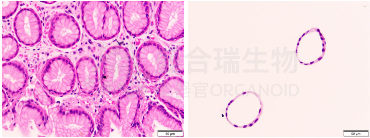 人胃上皮类器官HE染色