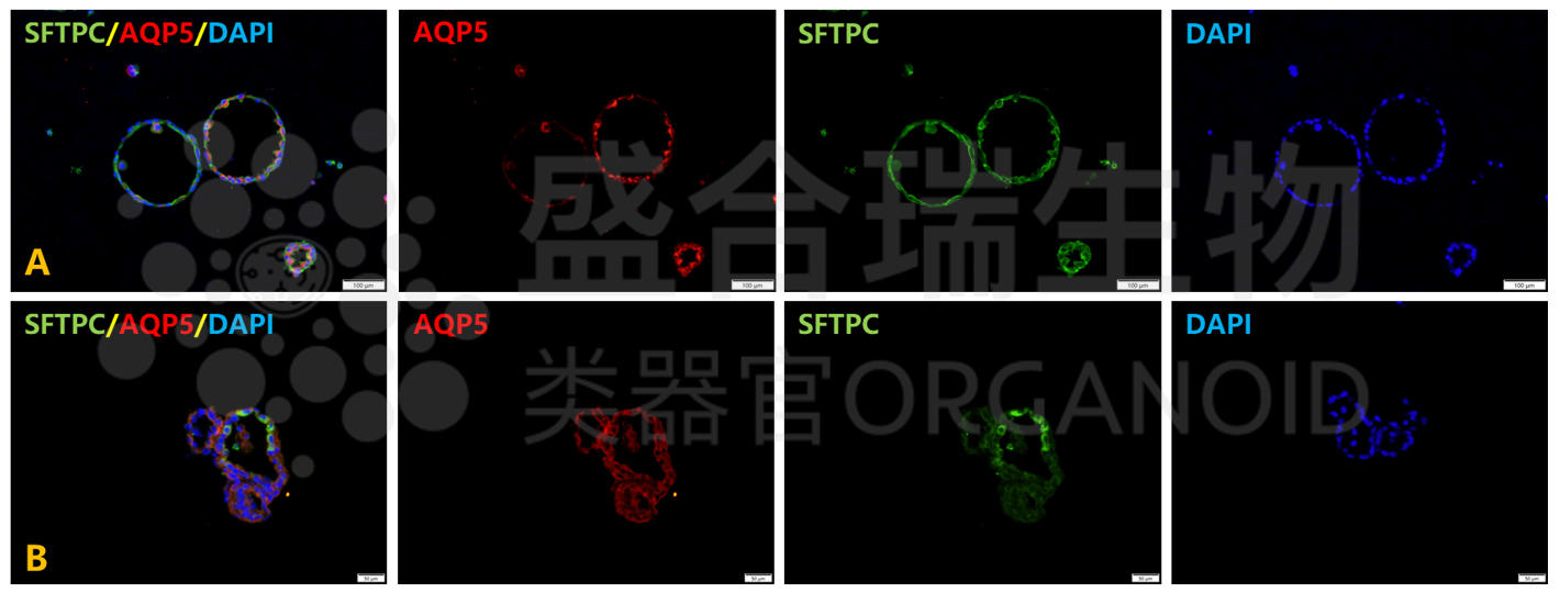小鼠肺泡类器官免疫荧光染色鉴定