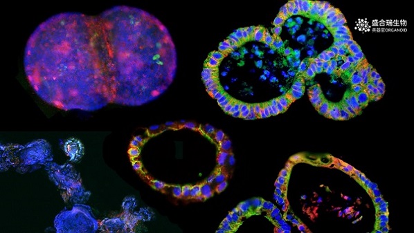类器官培养技术-盛合瑞生物